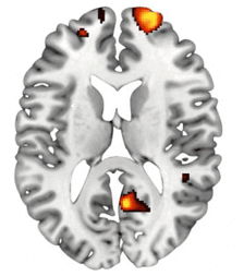 :fmri.gif
